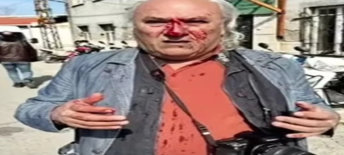 Dalaman TV Olarak Meslektaşımıza Yapılan Çirkin Saldırıyı Kınıyoruz